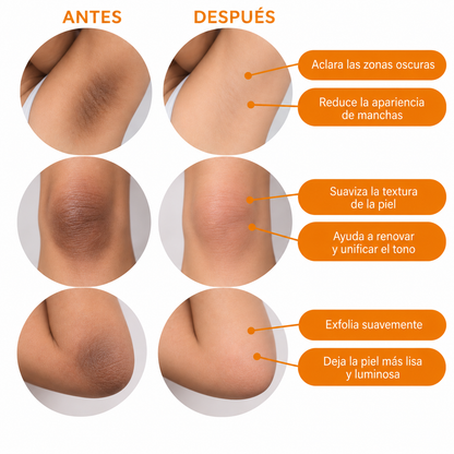 Spray Exfoliante Ácido Kójico y Cúrcuma